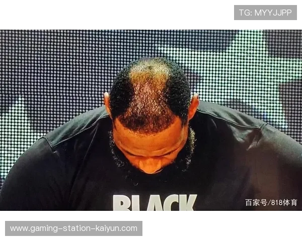 秃如其来!杜兰特被小球迷表白害羞低头,头顶头发稀疏一片地中海